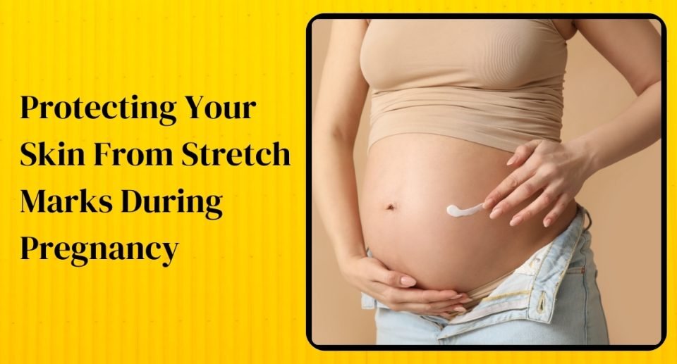 Protecting Your Skin From Stretch Marks During Pregnancy