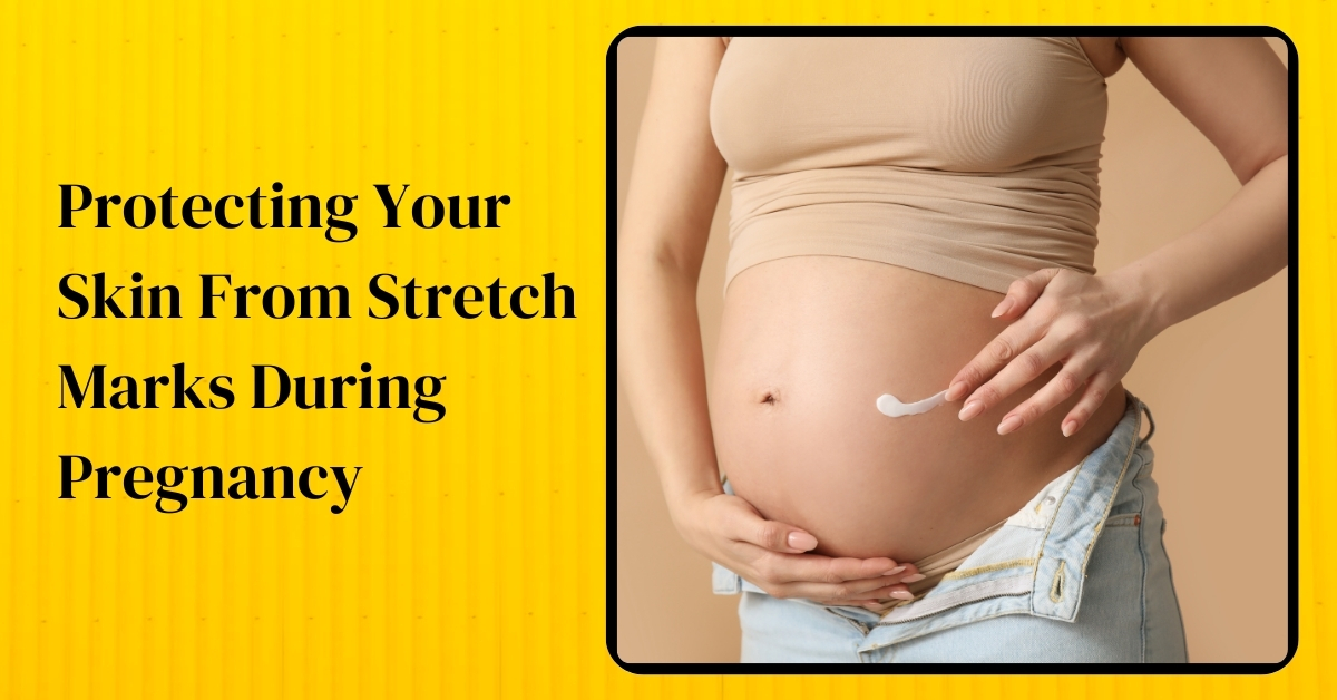 Protecting Your Skin From Stretch Marks During Pregnancy