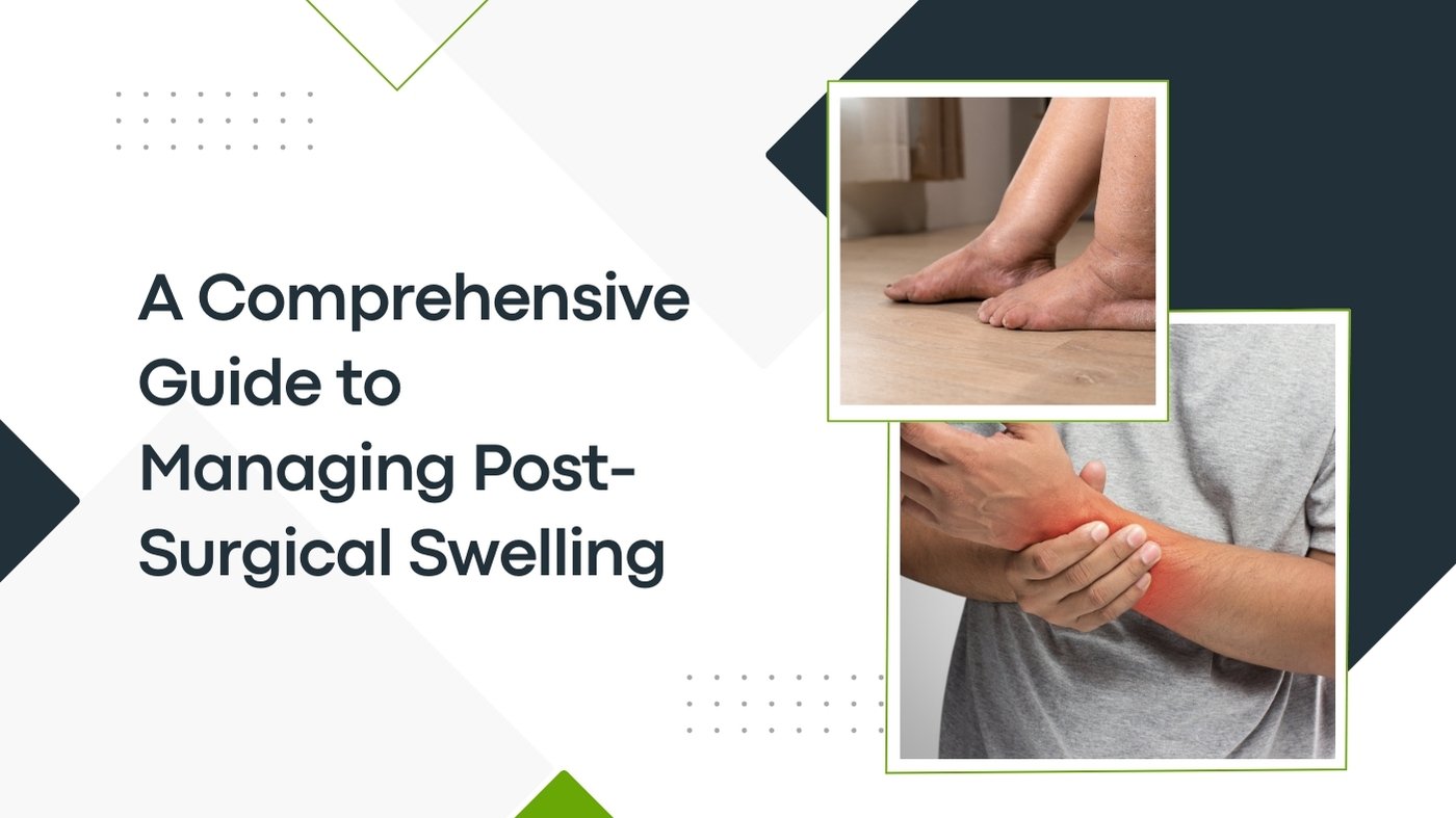 A Comprehensive Guide to Managing Post-Surgical Swelling